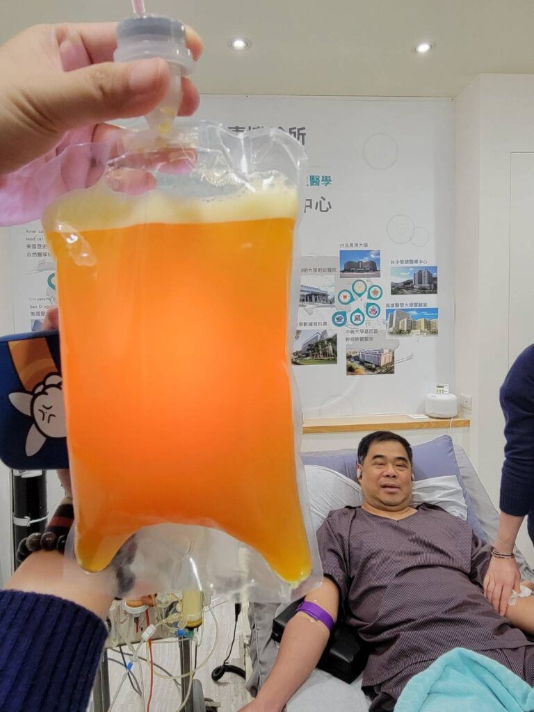 陳大哥血液淨化療程後的廢液