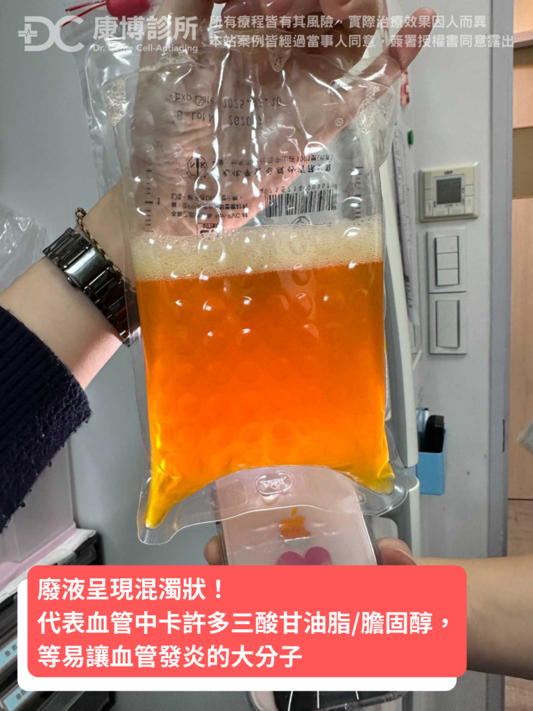看到洗出的廢液,潘大哥很感謝妹妹為了他的健康這麼擔心,以前總覺得人活著快樂就好,健康不重要,但做完血液淨化,發現整個人舒服很多,才發現人要先健康,才會快樂!