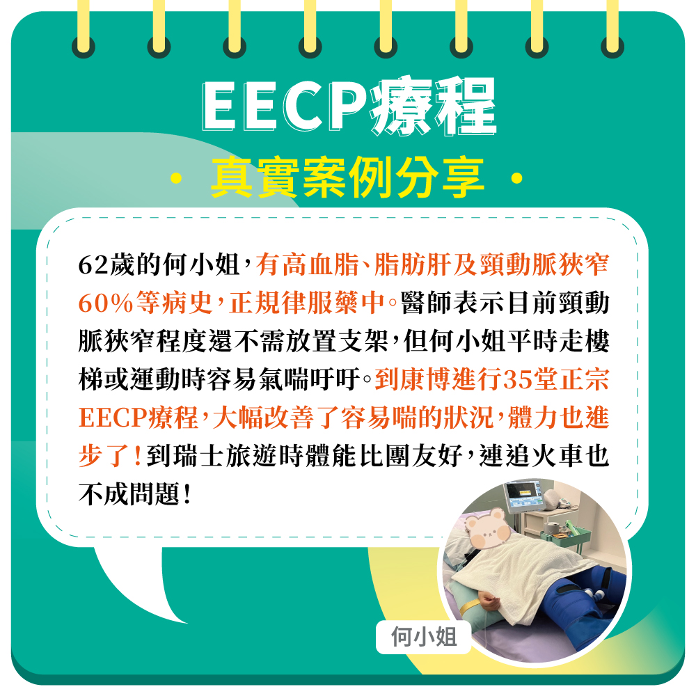 今年62歲的何小姐,有高血脂、脂肪肝及頸動脈狹窄60%等病史,正規律服藥中。醫師表示目前頸動脈狹窄程度不需放置支架,但平時走樓梯或運動時易喘。到康博諮詢後,進行35堂正宗EECP療程,大幅改善了容易喘的狀況!