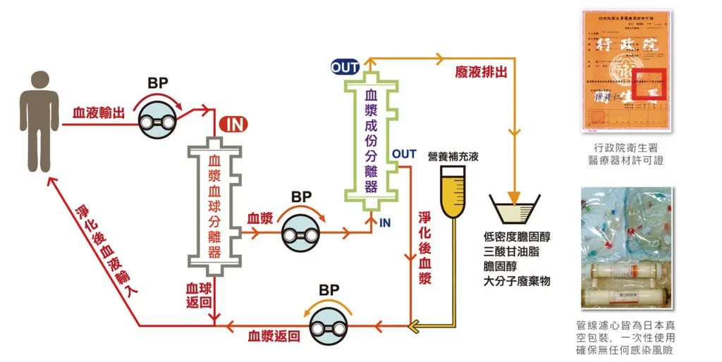 DFPP血液淨化過程及醫療許可證